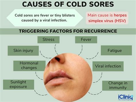 Cold Sores: Causes, Symptoms, Treatment, and Prevention