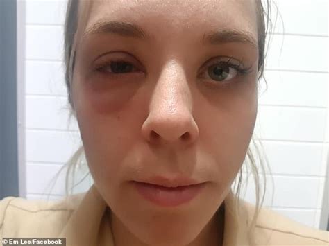 Australian mum suffers allergic reaction to nuts on domestic flight | Daily Mail Online