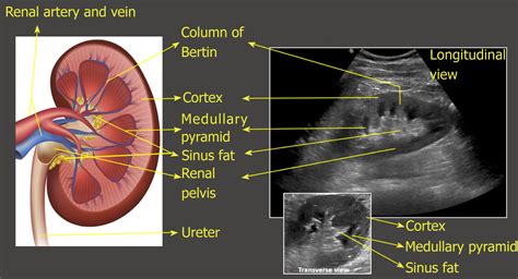 Renal artery doppler ultrasound - bkgilit