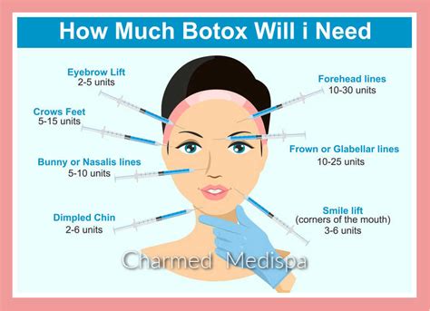 Botox How Much Will You Need – Units And Dosage Explained – Charmed Medispa