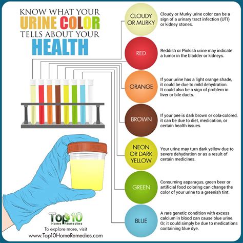 Know what Your Urine Color Tells about Your Health | Top 10 Home Remedies