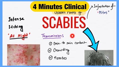 Scabies Vs Dermatitis