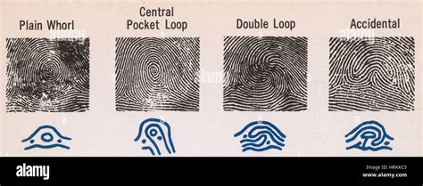 Radial Loop Fingerprint