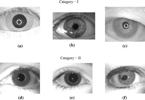 Iris images captured in different situations. Category I: a eyelid... | Download Scientific Diagram