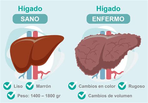 Funciones del hígado | Roche Pacientes