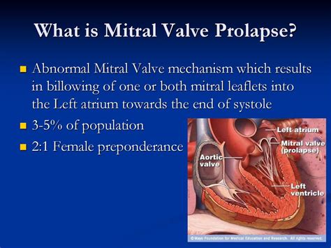 Mitral Valve Prolapse