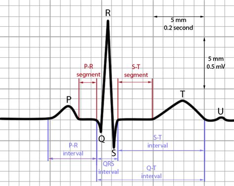 Basics of ECG- Interpretation of waves and intervals | Epomedicine