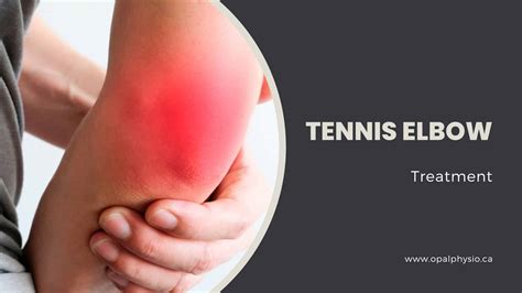 Tennis Elbow Physiotherapy Treatment