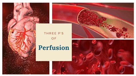 Perfusion Map