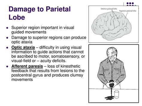 24+ Parietal Lobe Function Damage Pictures | 1000diagrams