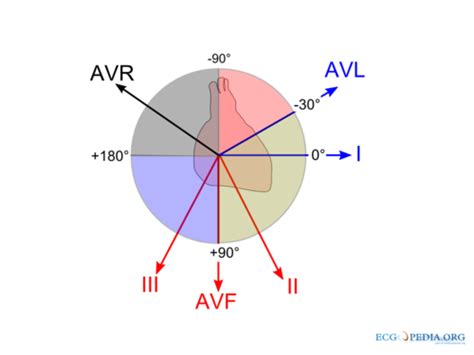 QRS axis - ECGpedia