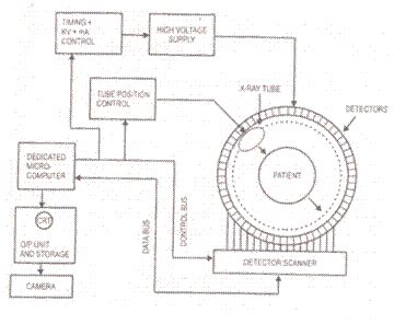 Ct Scan Block Diagram - Captions Hunter