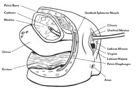 Foley Catheter Female Insertion at Nadine Wilkins blog