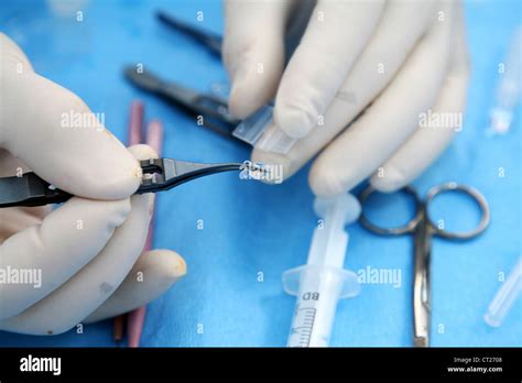 CATARACT, SURGERY Stock Photo - Alamy