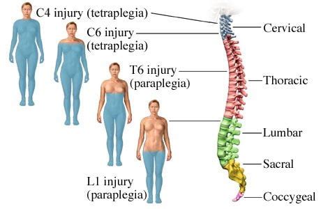 Stem Cell Treatment for Spinal Cord Injuries SCI Therapy