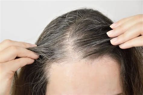 What is Telogen Effluvium and How Should You Treat it? 2022 - Hair Loss Geeks