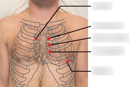 Landmarks of the Precordium Diagram | Quizlet