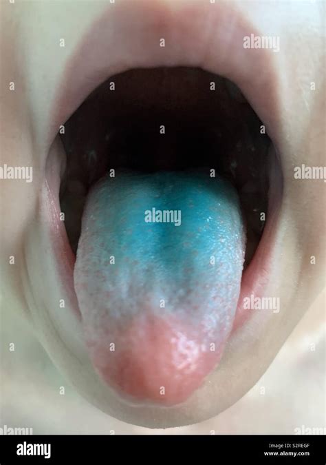 Blue tongue from eating sweets Stock Photo - Alamy