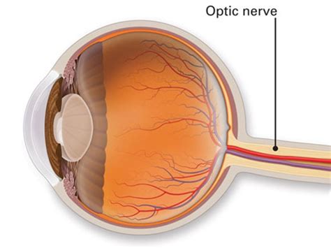 How the Optic Nerve Damage Causes Low Vision? - Zoomax