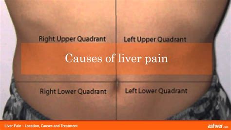 Liver Pain - Location, Causes and Treatment