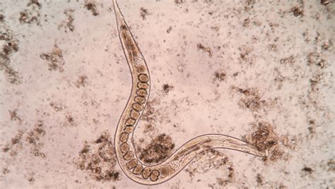 Man's Moving Rash Was Actually Worm Larvae Wriggling Under His Skin | IFLScience