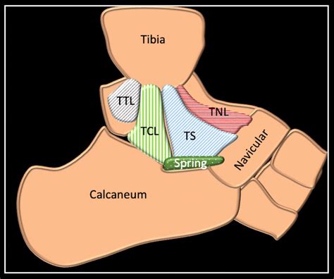 Deltoid Ligament Mri