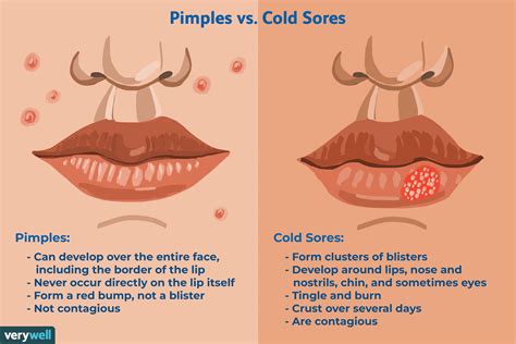 Cold Sore vs. Pimple: How to Tell the Difference