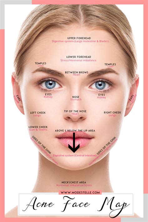 Face mapping acne chinese causes and remedies of acne – Artofit