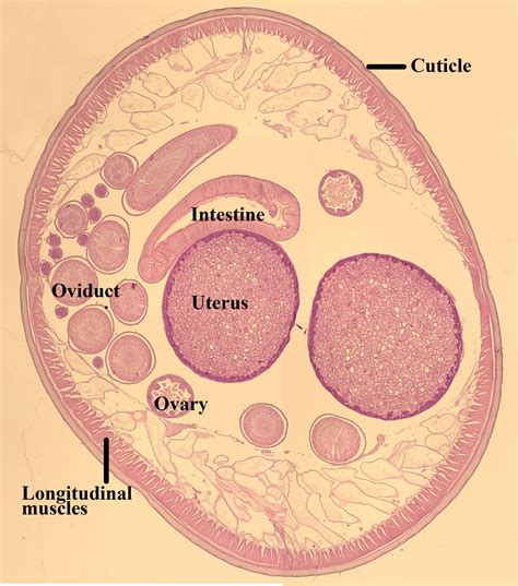 Ascaris lumbricoides – Female Cross Section – Parasitology