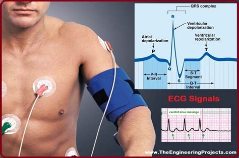 Electrocardiogram(ECG): Definition, Test, Signal Read & Diagnose - The ...