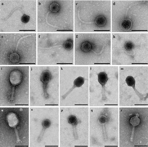 Negative staining electron microscopy images of Siphoviridae and... | Download Scientific Diagram