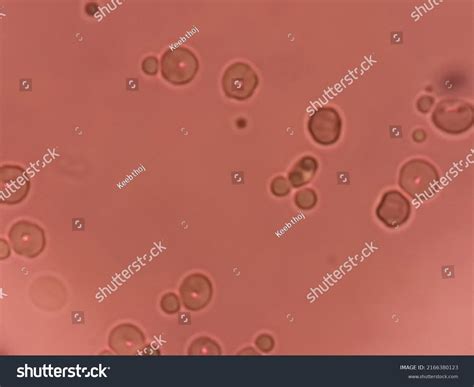 23 Dysmorphic rbc 图片、库存照片和矢量图 | Shutterstock