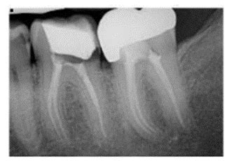 Why your claims with x-rays are being denied and what you can do ...