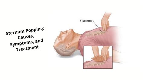 Sternum Popping: List of Causes, Symptoms, and Treatment