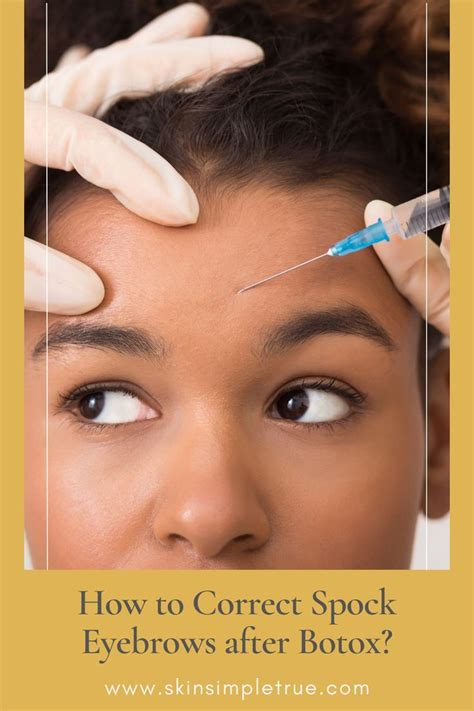 How to Correct Spock Eyebrows after Botox? | Botox, Eyebrows, Beauty ...