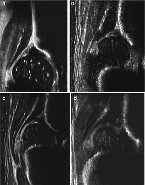 Small Part and Hip Ultrasound | Radiology Key