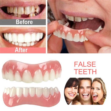 Veneers False teeth snap on instant Smile veneers Cosmetic Teeth ...