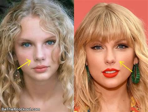 Taylor Swift Plastic Surgery Comparison Photos