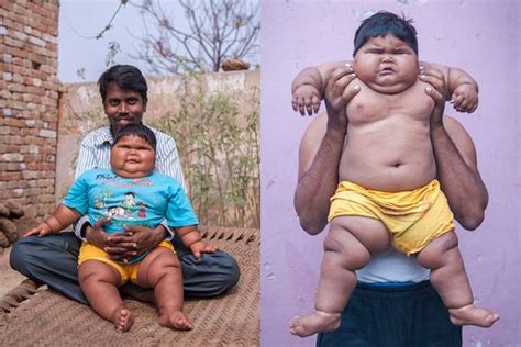 Tiny Titan: 10-Month-Old Indian Baby Earns 'Michelin Baby' Title with Remarkable 40kg Weight