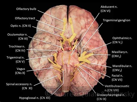 Summary of the Cranial Nerves - TeachMeAnatomy