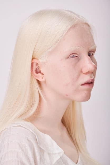 Premium Photo | Albino woman with unusual appearance