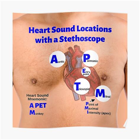 "Heart Sound Locations with a Stethoscope" Poster by Caregiverology ...