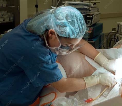 Foley catheter insertion - Stock Image - C029/9312 - Science Photo Library