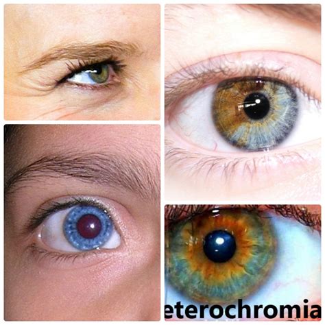 Heterochromia Iridum—People With Two Different Colored Eyes - Owlcation