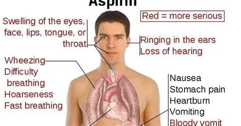 Clinical Pharmacy Cases: Aspirin Side Effects