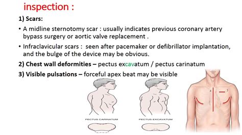 CS 2 CARDIOVASCULAR EXAMINATION - Precordium - by Dr Zaid - YouTube