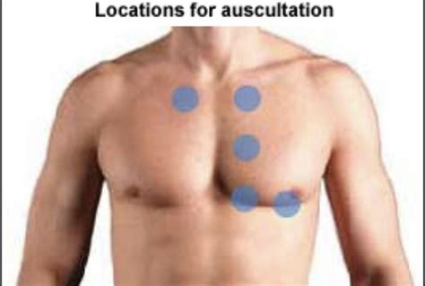 Health assessment: heart sound auscultation Diagram | Quizlet