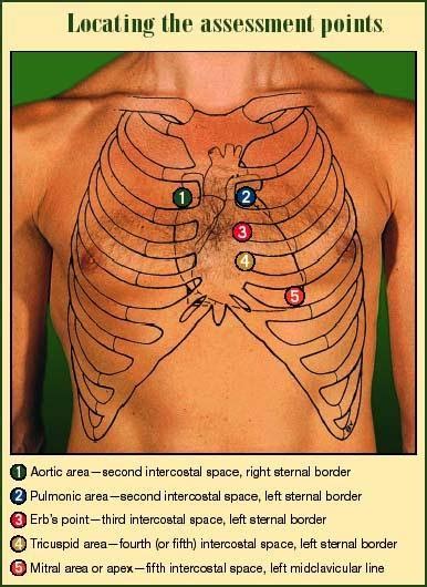 Anatomy and Physiology 2 Eportfolio: Objective 27: Heart Sounds