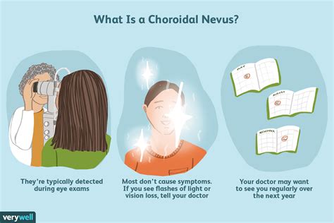 Choroidal Nevus: A Freckle in the Eye