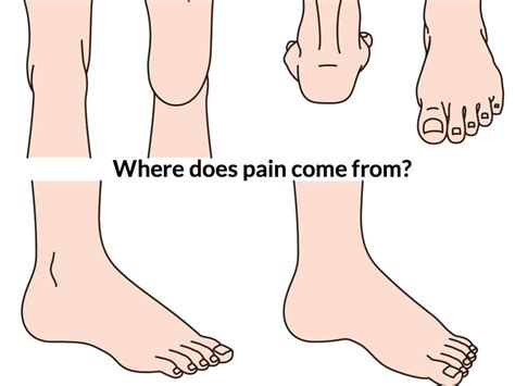 Locating foot pain - Consulting Footpain